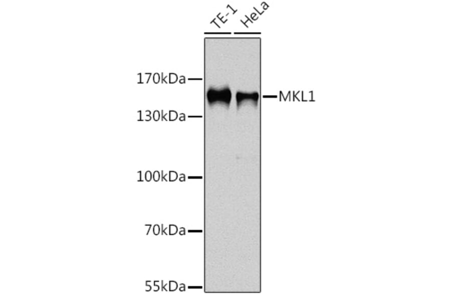 Western Blot - Anti-Mkl1/MRTFA Antibody (A92080) - Antibodies.com