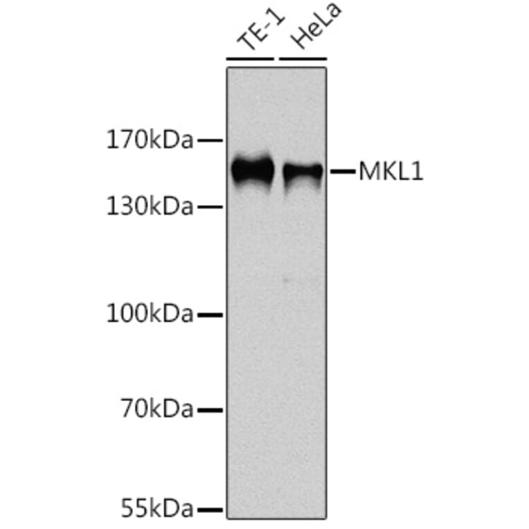 Western Blot - Anti-Mkl1/MRTFA Antibody (A92080) - Antibodies.com