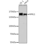 Western Blot - Anti-Mkl1/MRTFA Antibody (A92080) - Antibodies.com