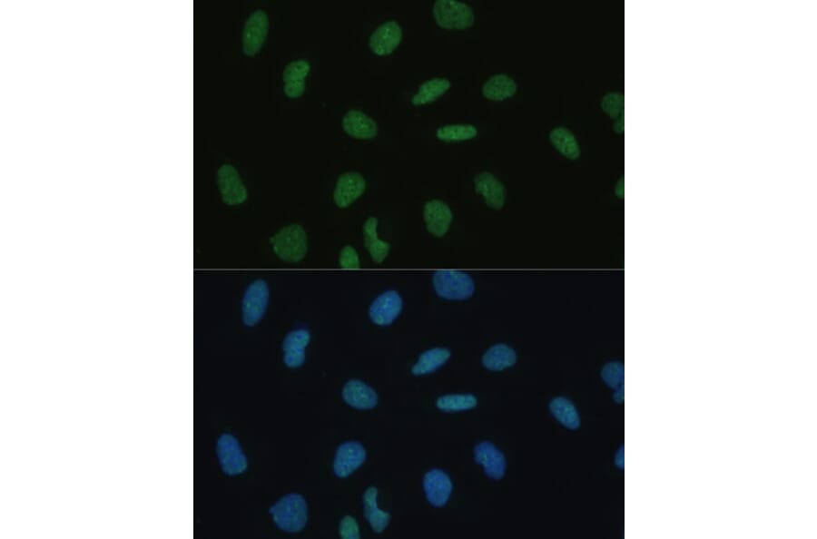 Immunofluorescence - Anti-Mkl1/MRTFA Antibody (A92080) - Antibodies.com