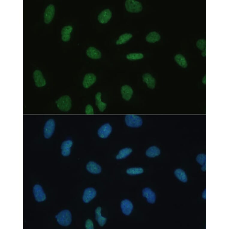 Immunofluorescence - Anti-Mkl1/MRTFA Antibody (A92080) - Antibodies.com