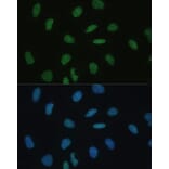 Immunofluorescence - Anti-Mkl1/MRTFA Antibody (A92080) - Antibodies.com