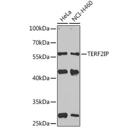 Western Blot - Anti-TERF2IP Antibody (A92081) - Antibodies.com