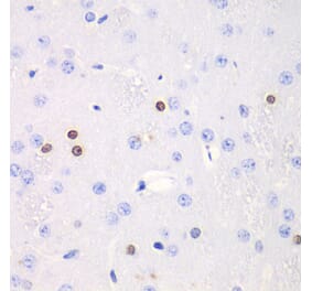 Immunohistochemistry - Anti-Transketolase Antibody (A92082) - Antibodies.com