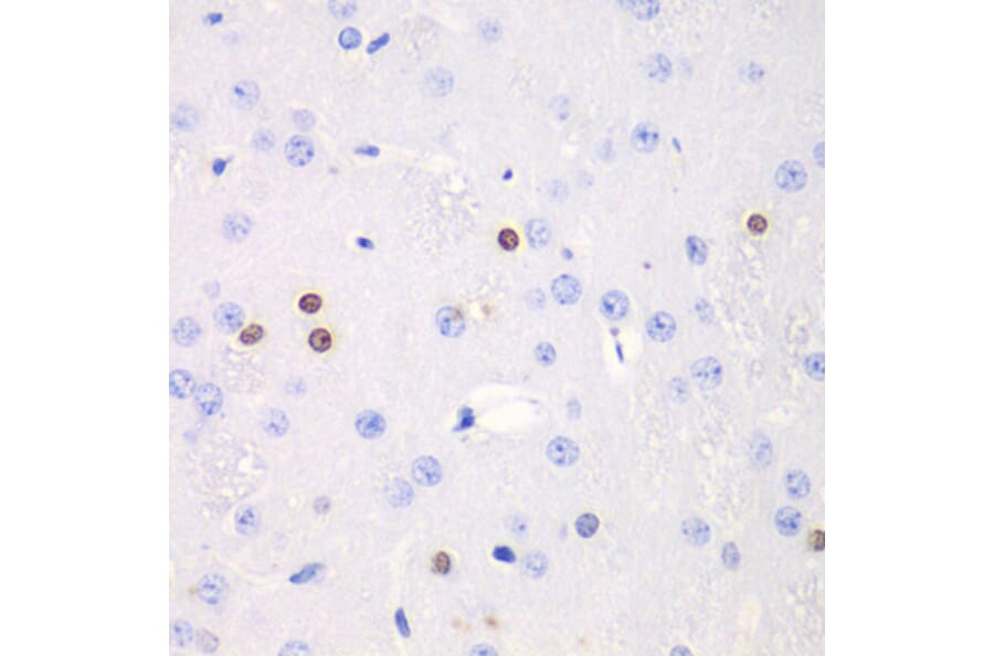 Immunohistochemistry - Anti-Transketolase Antibody (A92082) - Antibodies.com