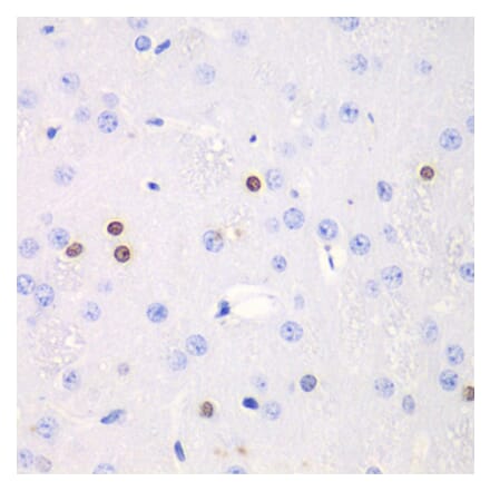 Immunohistochemistry - Anti-Transketolase Antibody (A92082) - Antibodies.com