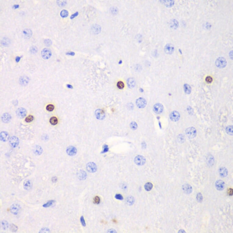 Immunohistochemistry - Anti-Transketolase Antibody (A92082) - Antibodies.com