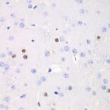 Immunohistochemistry - Anti-Transketolase Antibody (A92082) - Antibodies.com