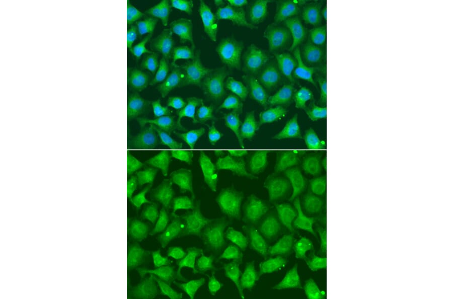 Immunofluorescence - Anti-XRCC2 Antibody (A13639) - Antibodies.com