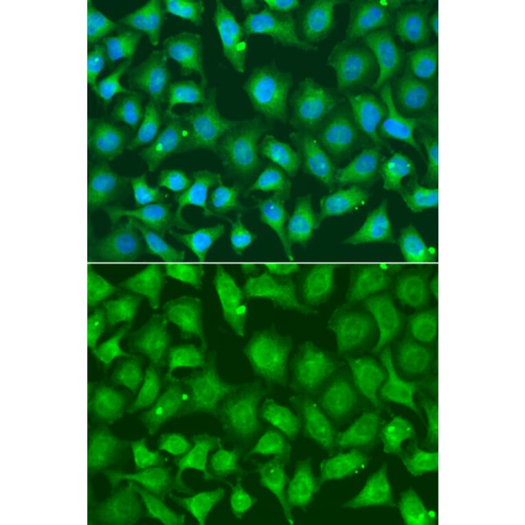 Immunofluorescence - Anti-XRCC2 Antibody (A13639) - Antibodies.com