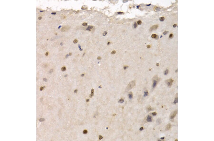 Immunohistochemistry - Anti-RAD1 Antibody (A6841) - Antibodies.com