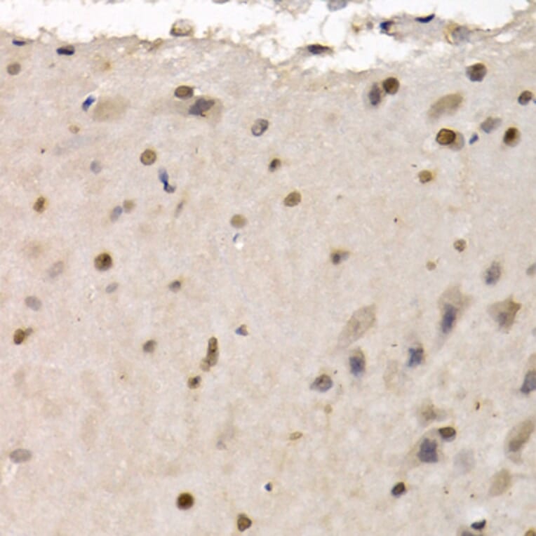 Immunohistochemistry - Anti-RAD1 Antibody (A6841) - Antibodies.com