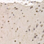 Immunohistochemistry - Anti-RAD1 Antibody (A6841) - Antibodies.com