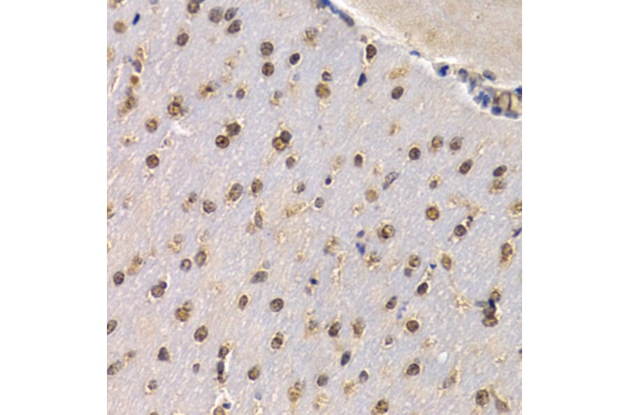 Immunohistochemistry - Anti-RAD1 Antibody (A6841) - Antibodies.com
