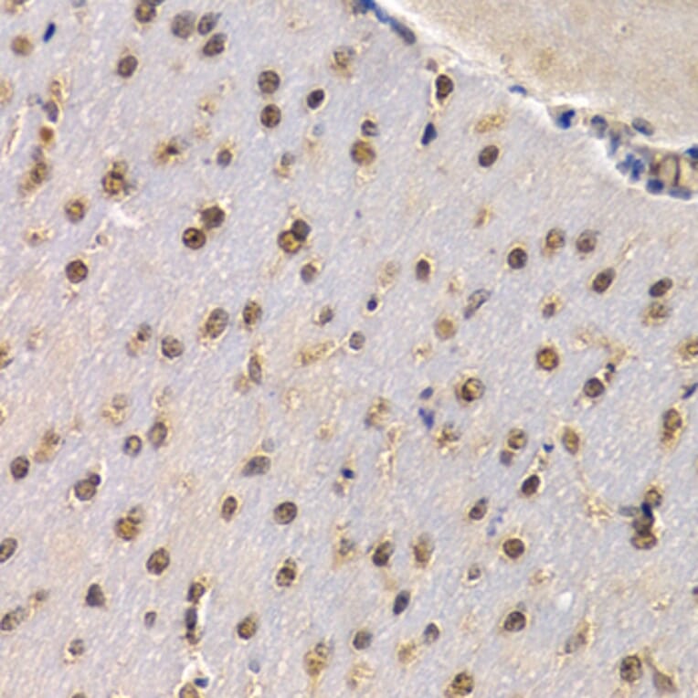 Immunohistochemistry - Anti-RAD1 Antibody (A6841) - Antibodies.com