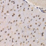 Immunohistochemistry - Anti-RAD1 Antibody (A6841) - Antibodies.com