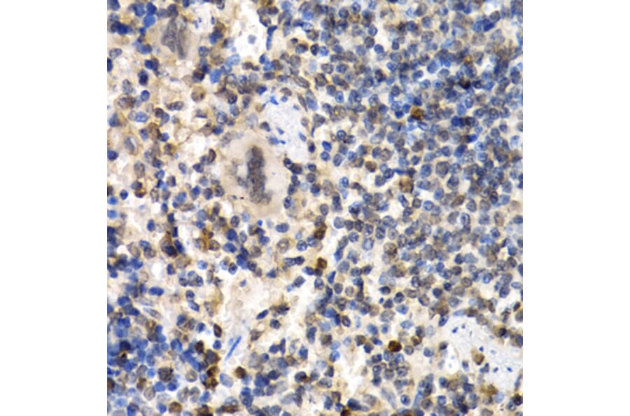 Immunohistochemistry - Anti-RAD1 Antibody (A6841) - Antibodies.com