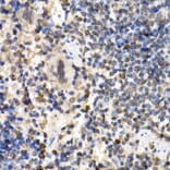 Immunohistochemistry - Anti-RAD1 Antibody (A6841) - Antibodies.com