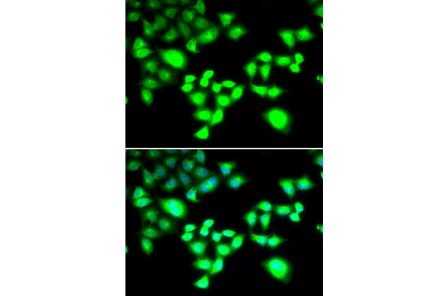 Immunofluorescence - Anti-RAD1 Antibody (A6841) - Antibodies.com