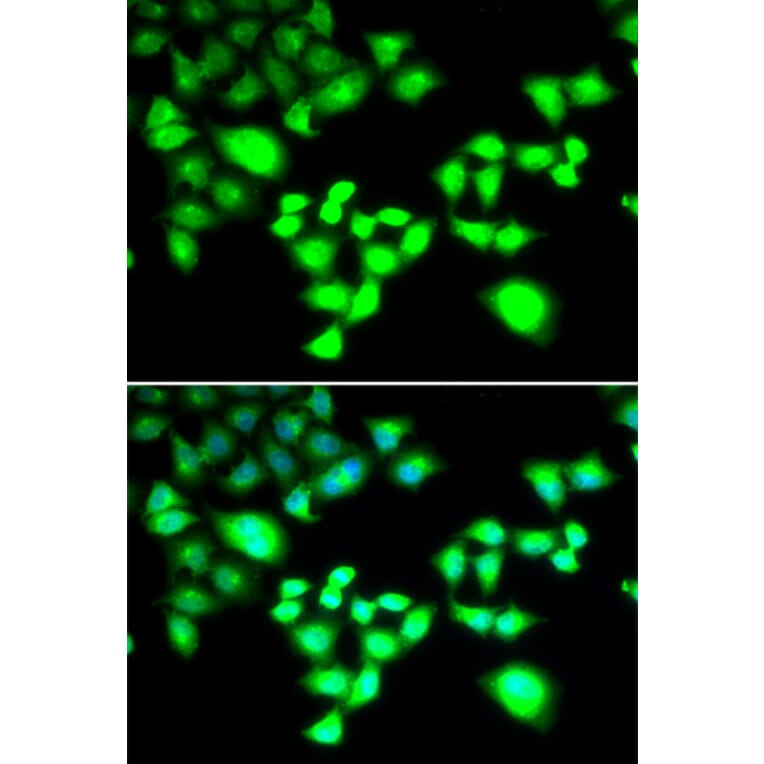 Immunofluorescence - Anti-RAD1 Antibody (A6841) - Antibodies.com