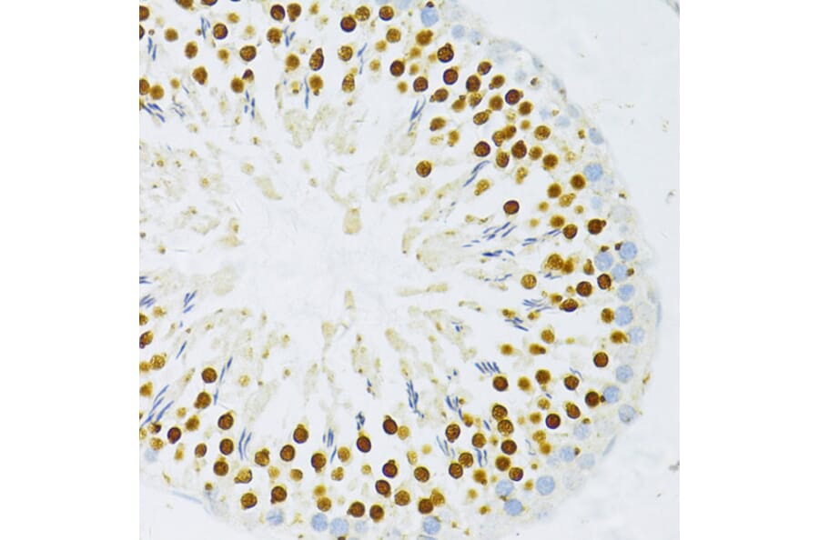 Immunohistochemistry - Anti-DP1 Antibody (A92089) - Antibodies.com