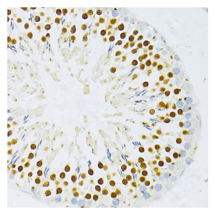 Immunohistochemistry - Anti-DP1 Antibody (A92089) - Antibodies.com