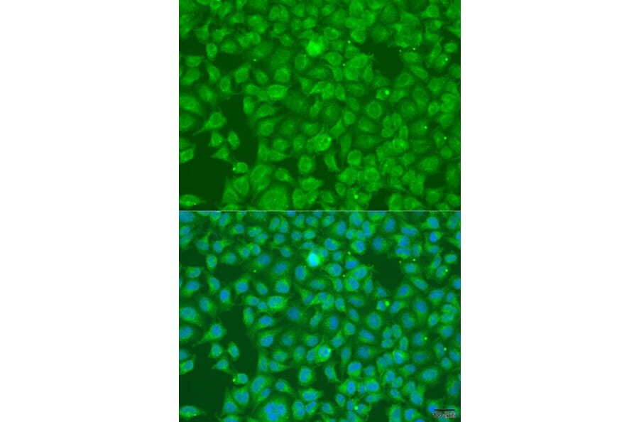 Immunofluorescence - Anti-SLC25A6 Antibody (A15029) - Antibodies.com