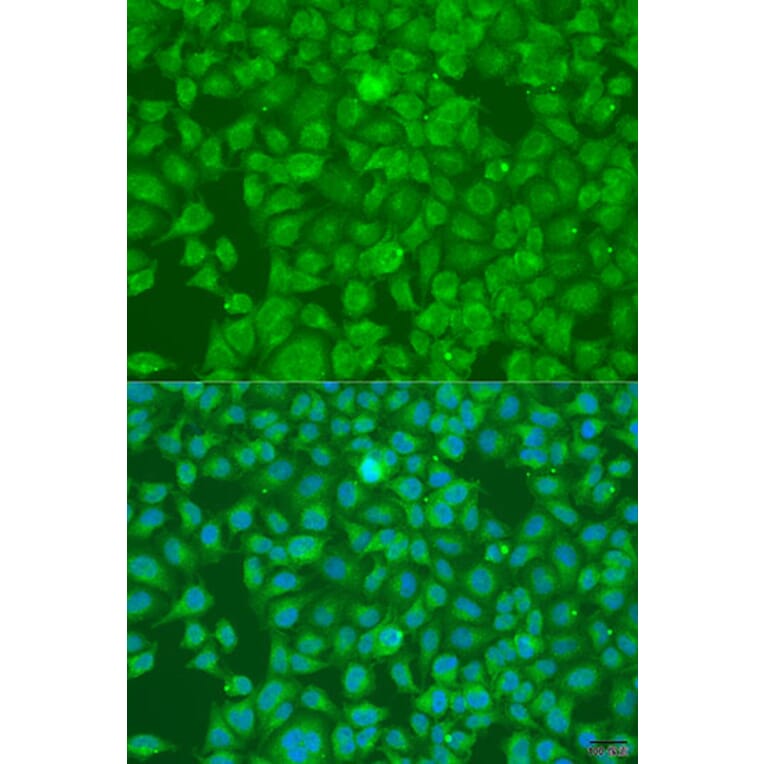 Immunofluorescence - Anti-SLC25A6 Antibody (A15029) - Antibodies.com