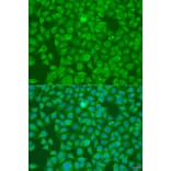 Immunofluorescence - Anti-SLC25A6 Antibody (A15029) - Antibodies.com