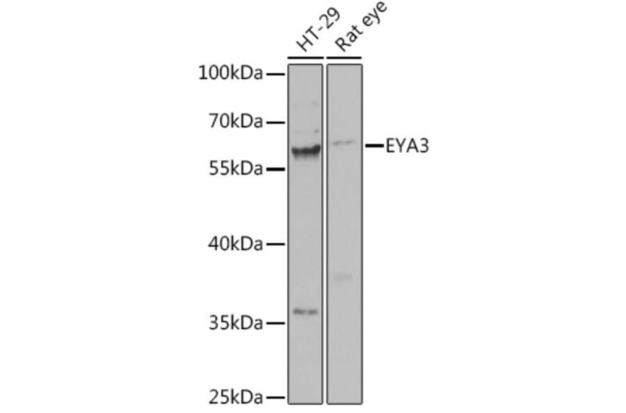 Western Blot - Anti-EYA3 Antibody (A92094) - Antibodies.com