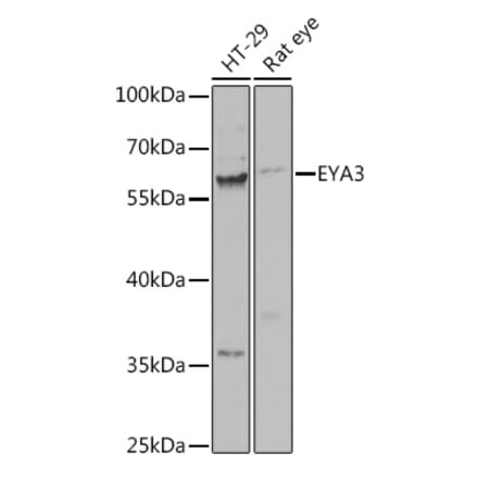 Western Blot - Anti-EYA3 Antibody (A92094) - Antibodies.com