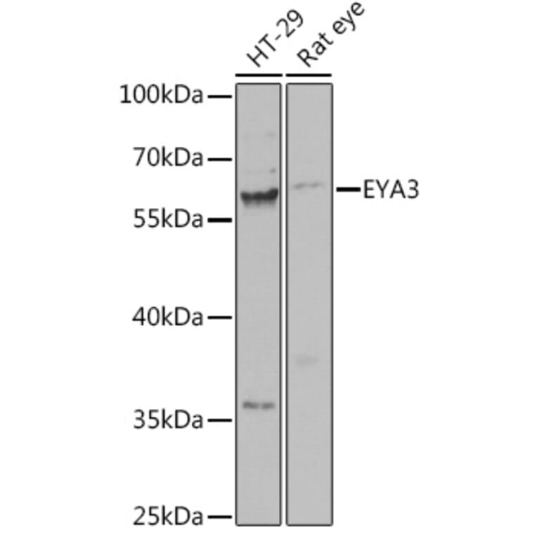 Western Blot - Anti-EYA3 Antibody (A92094) - Antibodies.com
