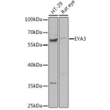 Western Blot - Anti-EYA3 Antibody (A92094) - Antibodies.com