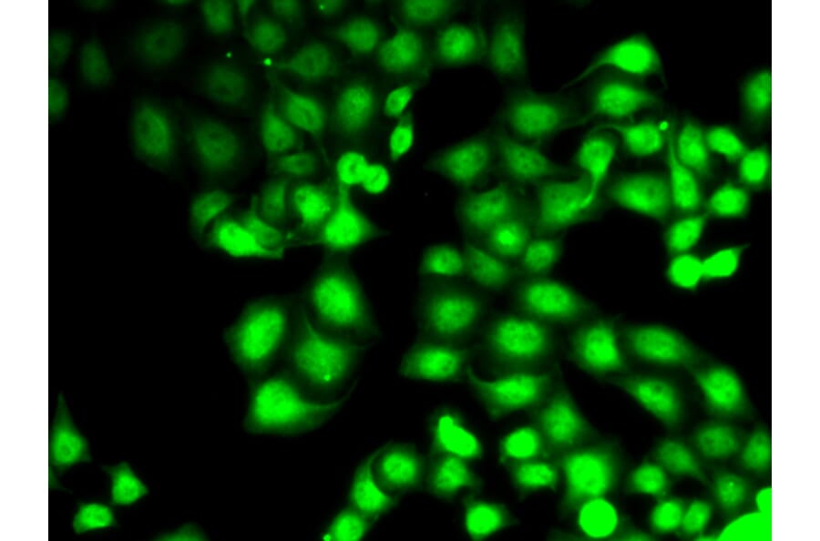 Immunofluorescence - Anti-GCK Antibody (A0431) - Antibodies.com