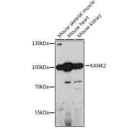 Western Blot - Anti-KANK2 Antibody (A92096) - Antibodies.com
