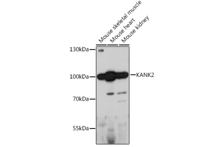 Western Blot - Anti-KANK2 Antibody (A92096) - Antibodies.com