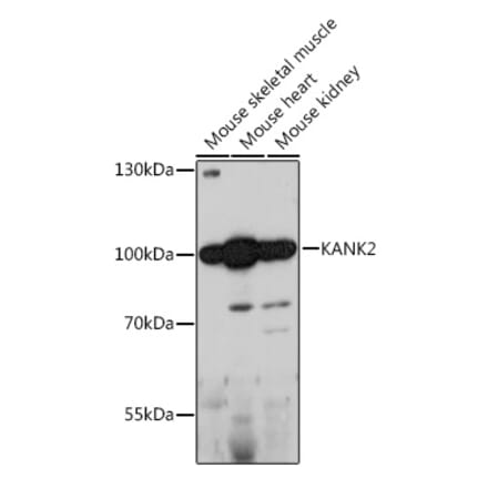 Western Blot - Anti-KANK2 Antibody (A92096) - Antibodies.com