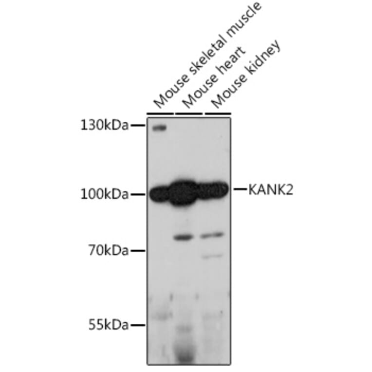 Western Blot - Anti-KANK2 Antibody (A92096) - Antibodies.com