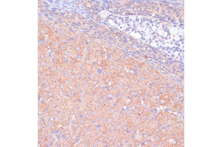 Immunohistochemistry - Anti-KANK2 Antibody (A92096) - Antibodies.com
