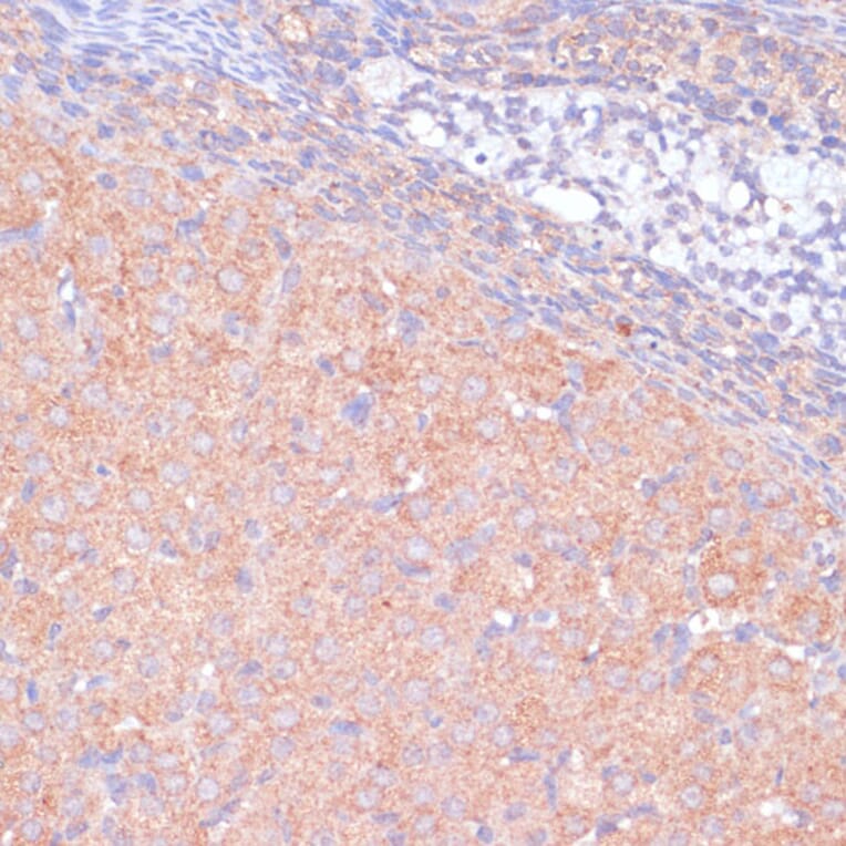 Immunohistochemistry - Anti-KANK2 Antibody (A92096) - Antibodies.com