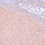 Immunohistochemistry - Anti-KANK2 Antibody (A92096) - Antibodies.com