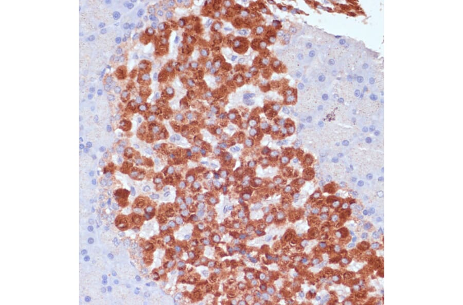 Immunohistochemistry - Anti-KANK2 Antibody (A92096) - Antibodies.com