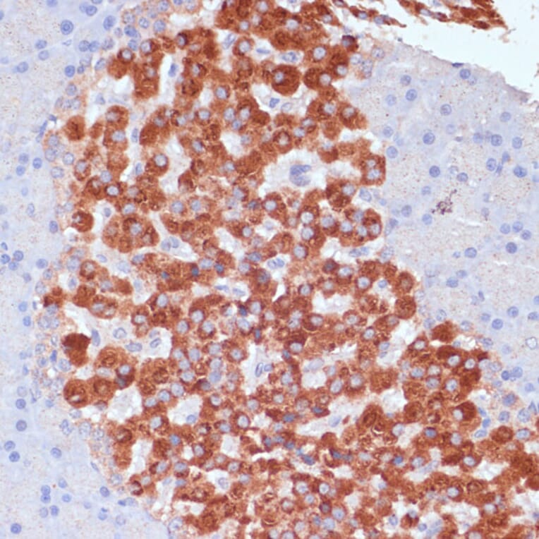 Immunohistochemistry - Anti-KANK2 Antibody (A92096) - Antibodies.com