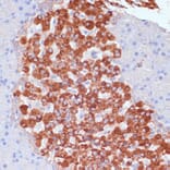 Immunohistochemistry - Anti-KANK2 Antibody (A92096) - Antibodies.com