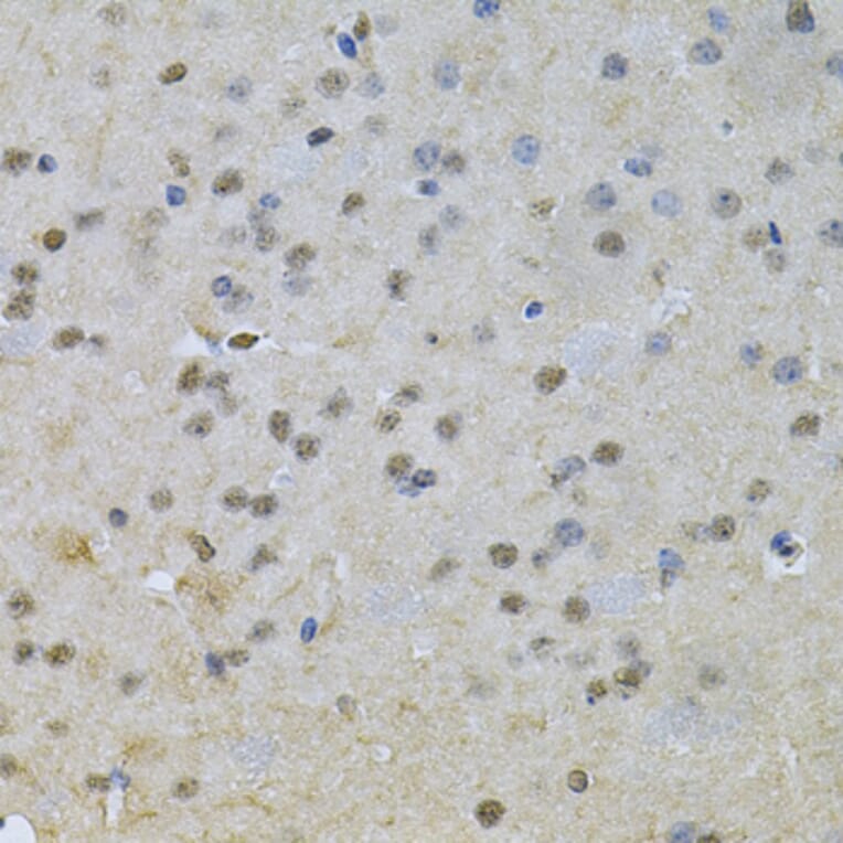 Immunohistochemistry - Anti-NRF1 Antibody (A14190) - Antibodies.com