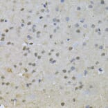 Immunohistochemistry - Anti-NRF1 Antibody (A14190) - Antibodies.com
