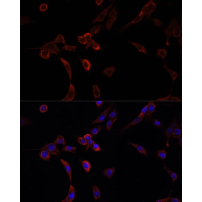 Immunofluorescence - Anti-NRF1 Antibody (A14190) - Antibodies.com