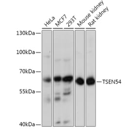 Western Blot - Anti-TSEN54 Antibody (A92103) - Antibodies.com