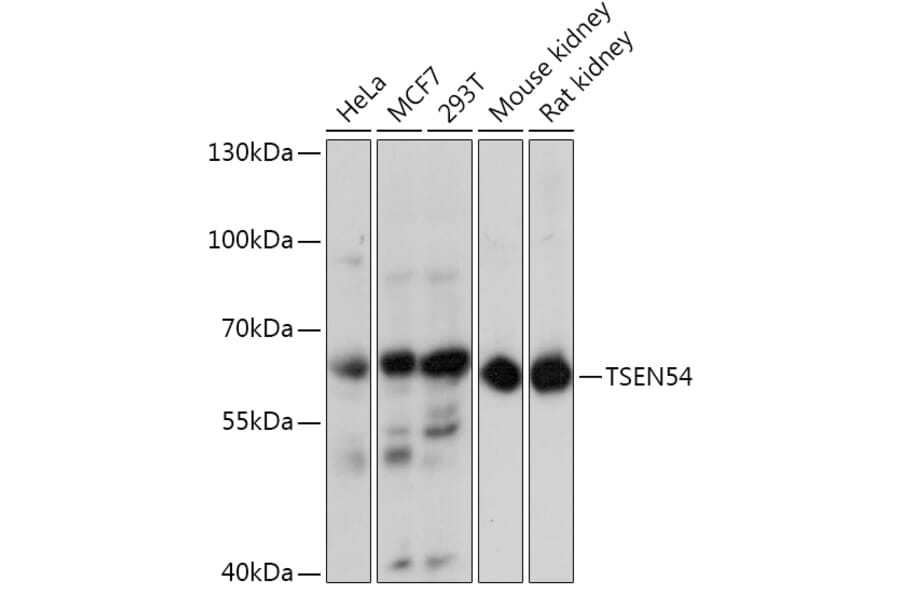 Western Blot - Anti-TSEN54 Antibody (A92103) - Antibodies.com