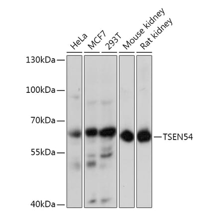 Western Blot - Anti-TSEN54 Antibody (A92103) - Antibodies.com